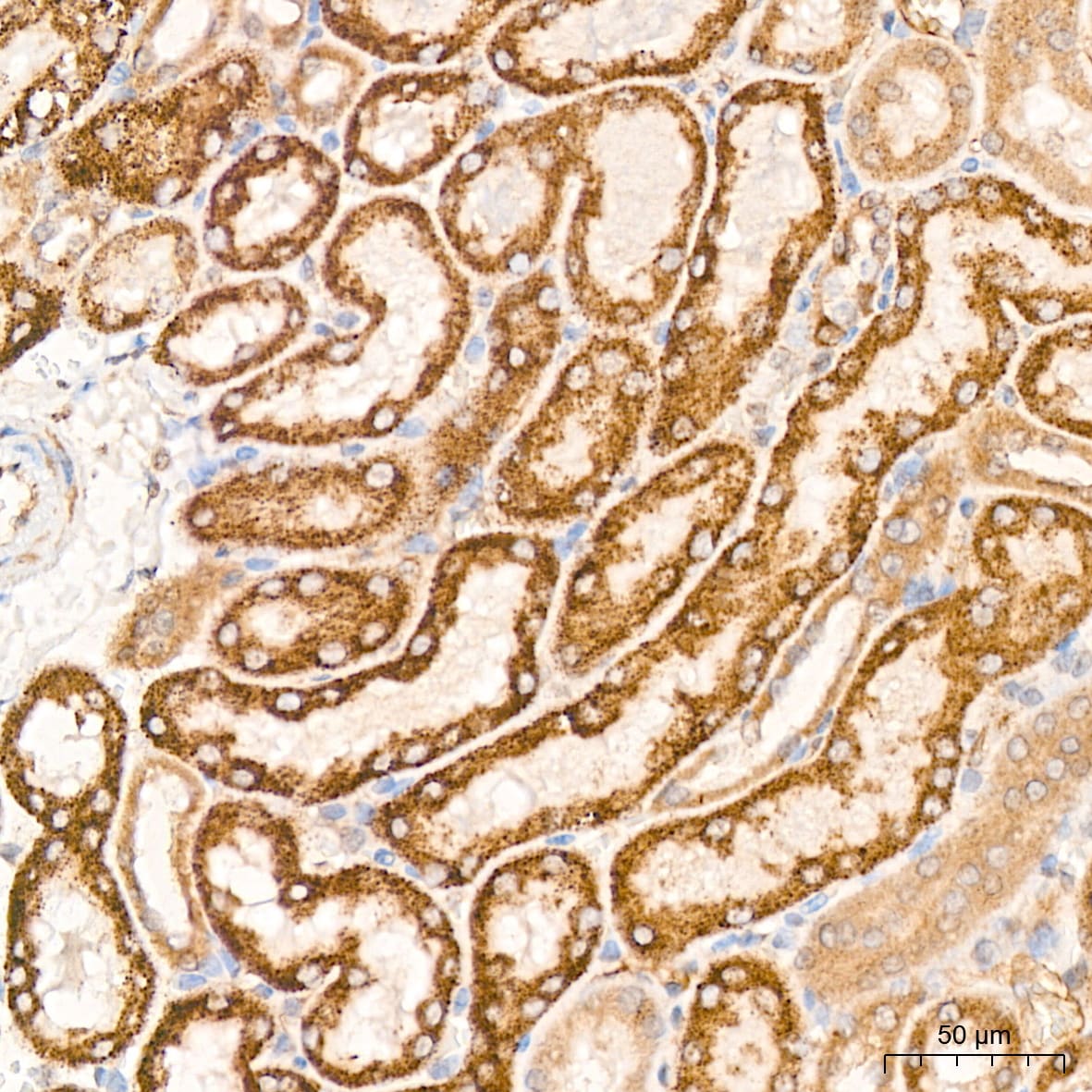 Pyruvate Dehydrogenase E1 beta subunit Antibody (7V8O5)