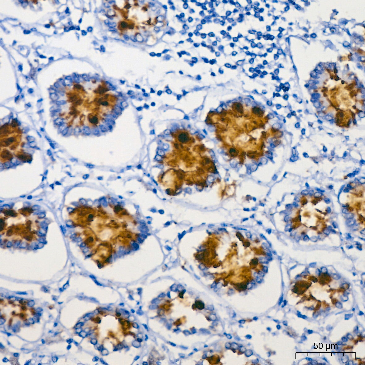 MUC2 Antibody (4L5Y8)