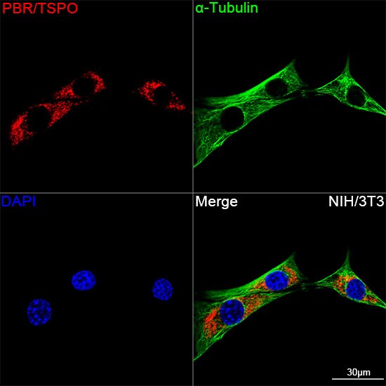 PBR Antibody (4I9K6)