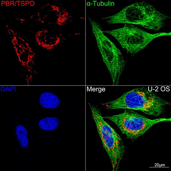 PBR Antibody (4I9K6)