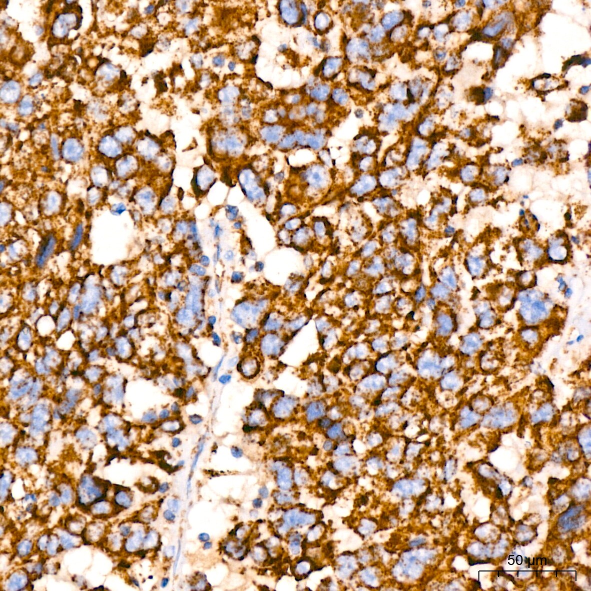 PBR Antibody (4I9K6)