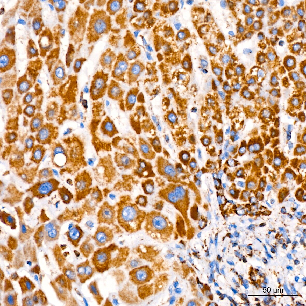 PBR Antibody (4I9K6)