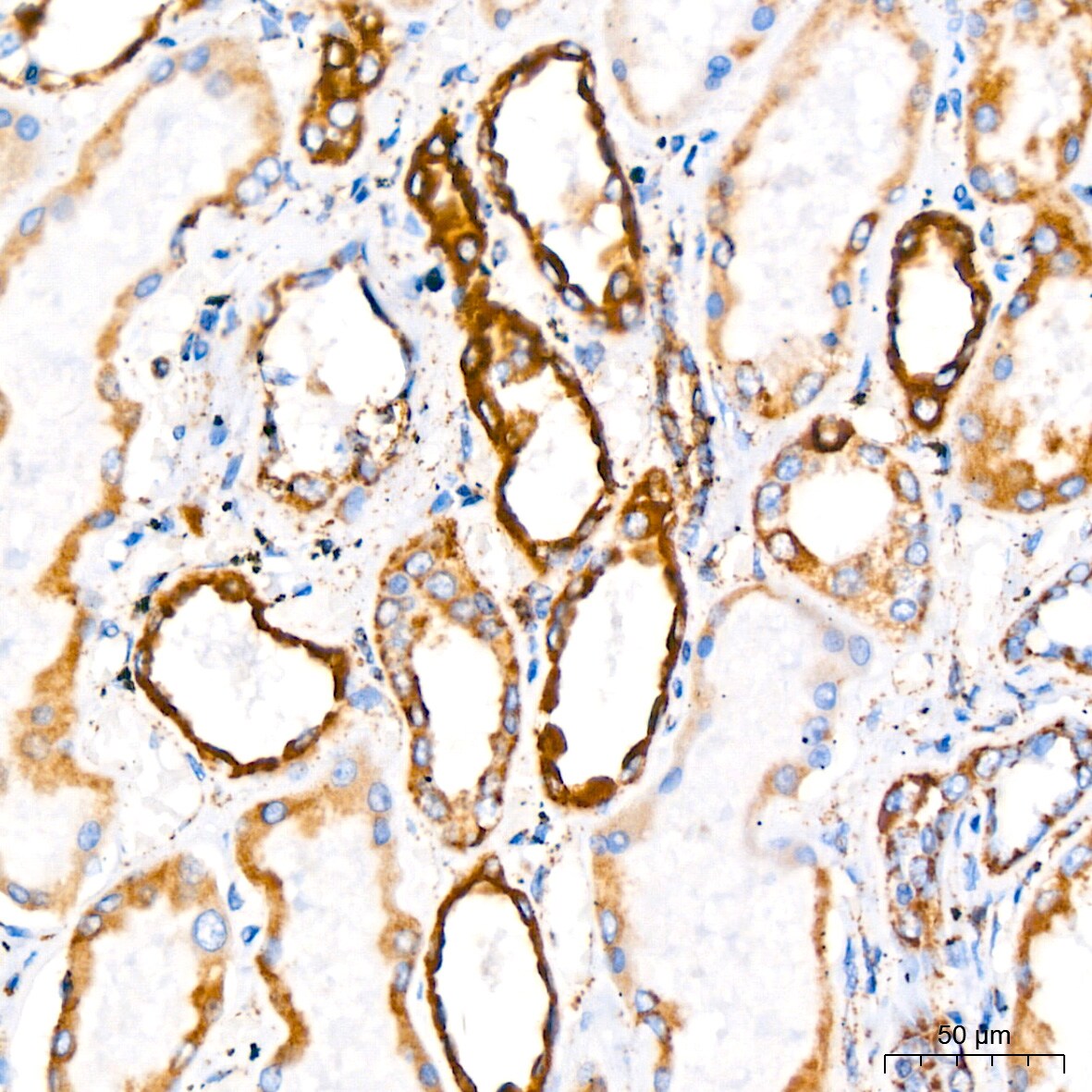 PBR Antibody (4I9K6)