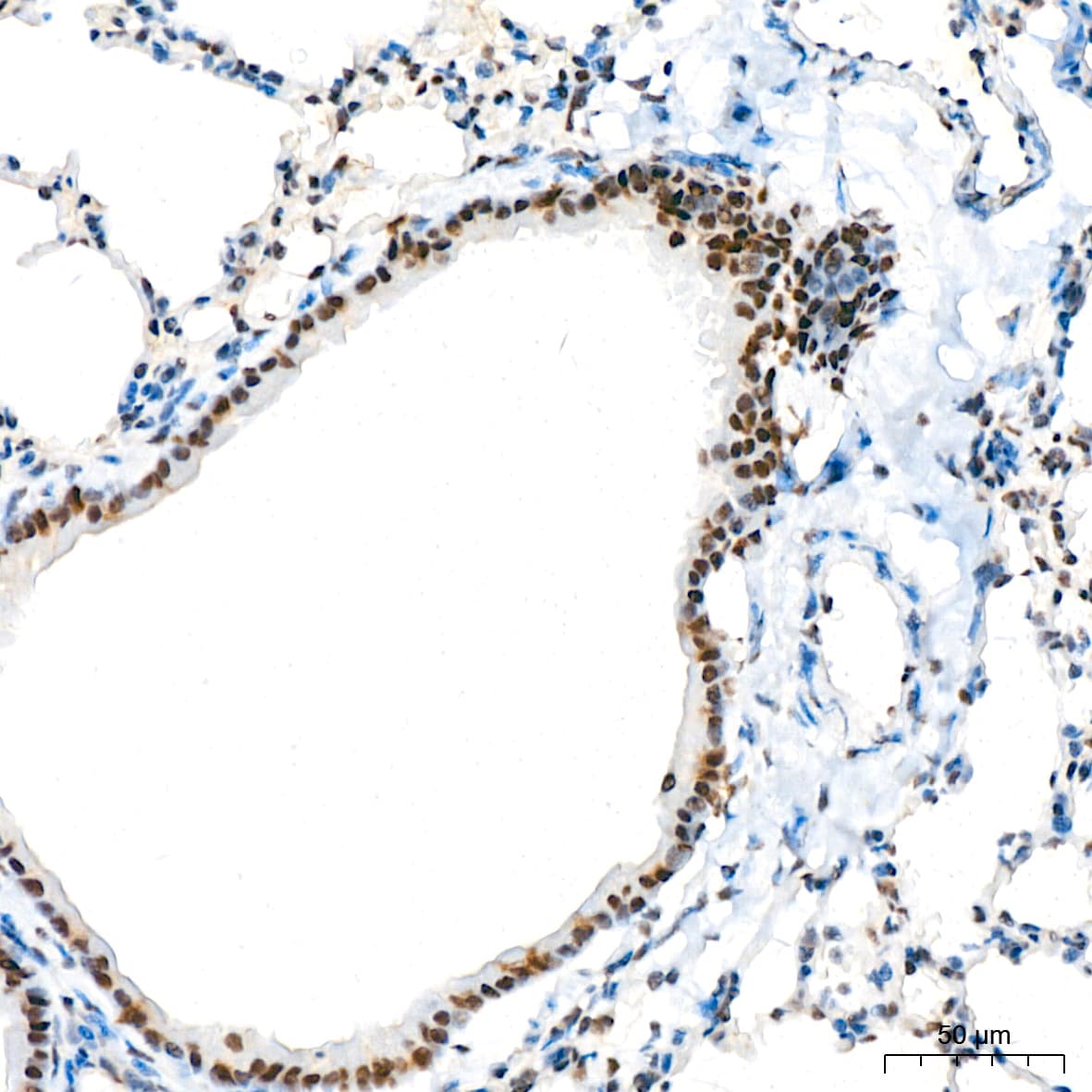 ASH2L Antibody (10B6U5)
