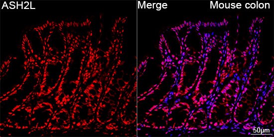 ASH2L Antibody (10B6U5)