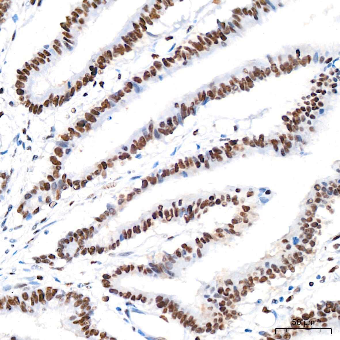 ASH2L Antibody (10B6U5)