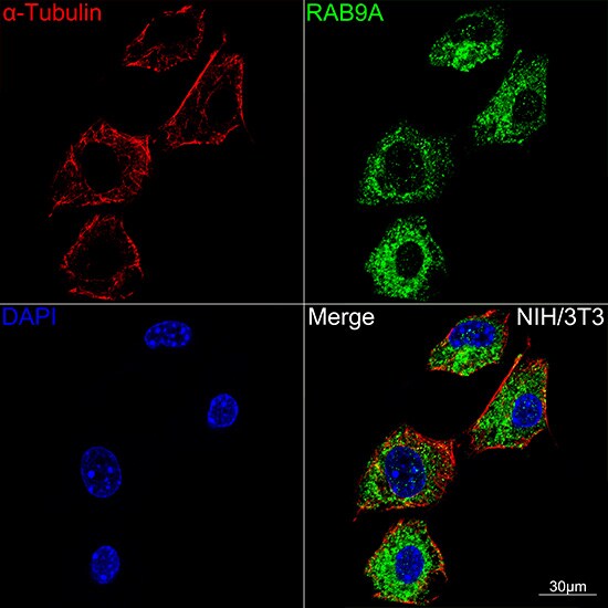 RAB9A Antibody (7O1G4)