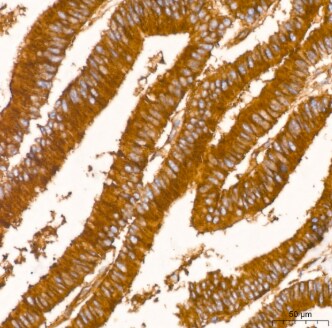 Clathrin Heavy Chain 1/CHC17 Antibody (9M2G2)