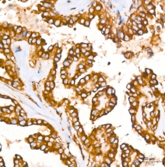Clathrin Heavy Chain 1/CHC17 Antibody (9M2G2)