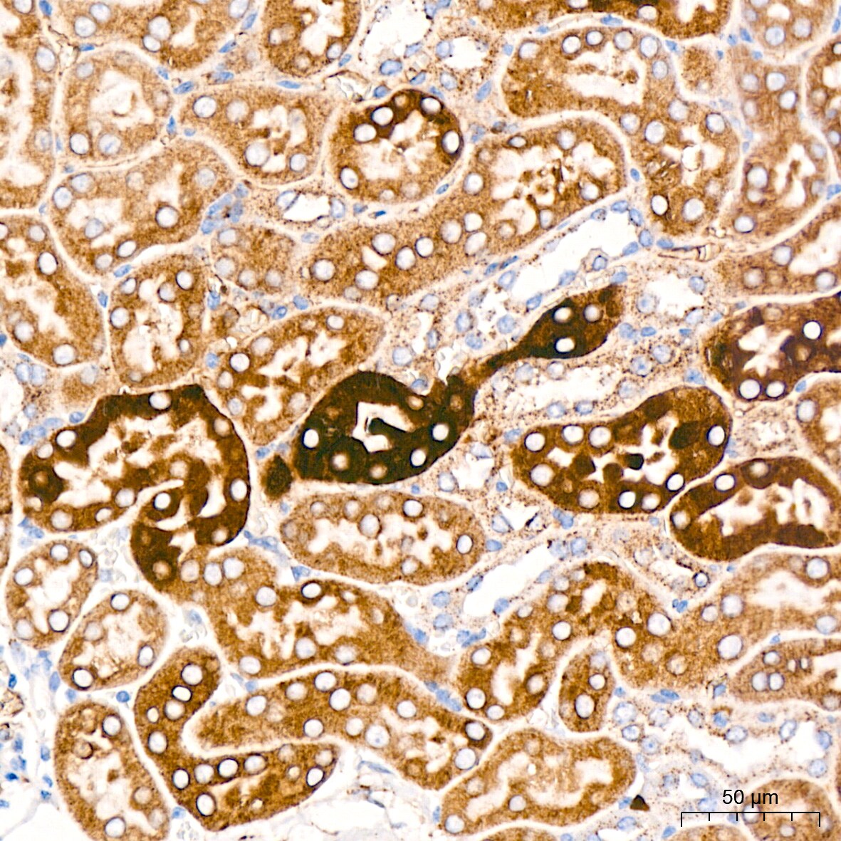 Cathepsin L/V/K/H Antibody (2Q10F10)