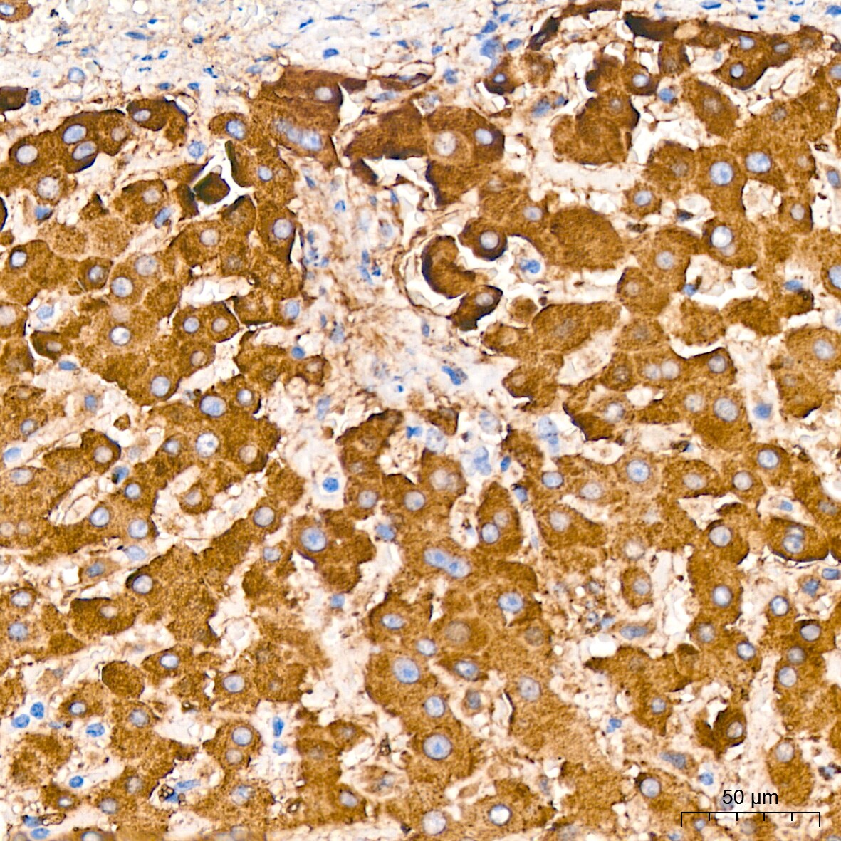 Cathepsin L/V/K/H Antibody (2Q10F10)