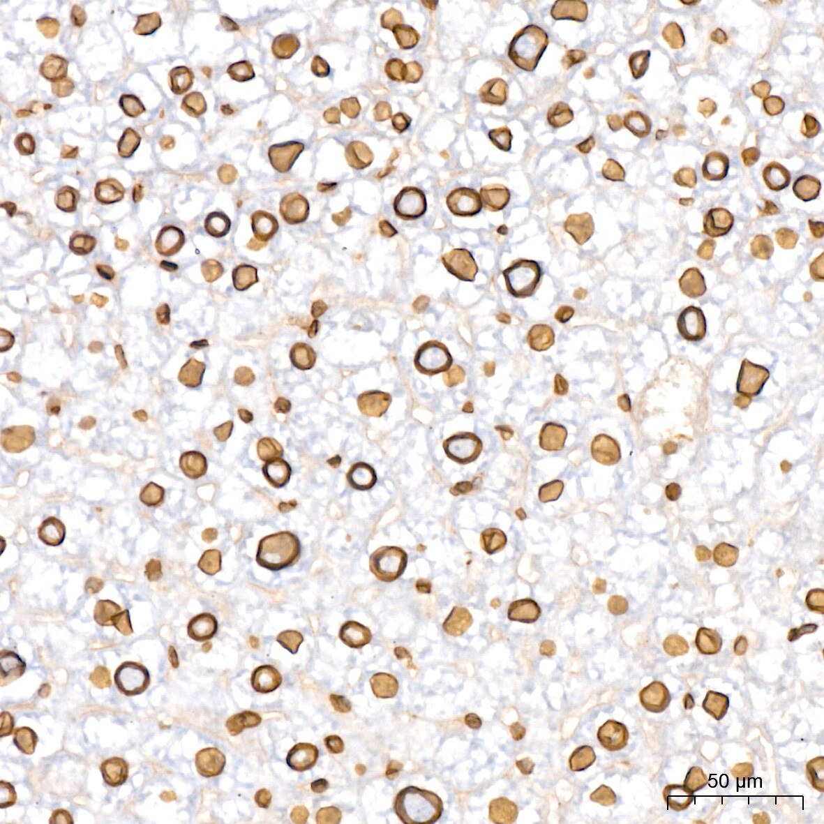 Lamin B2 Antibody (1S9M6)