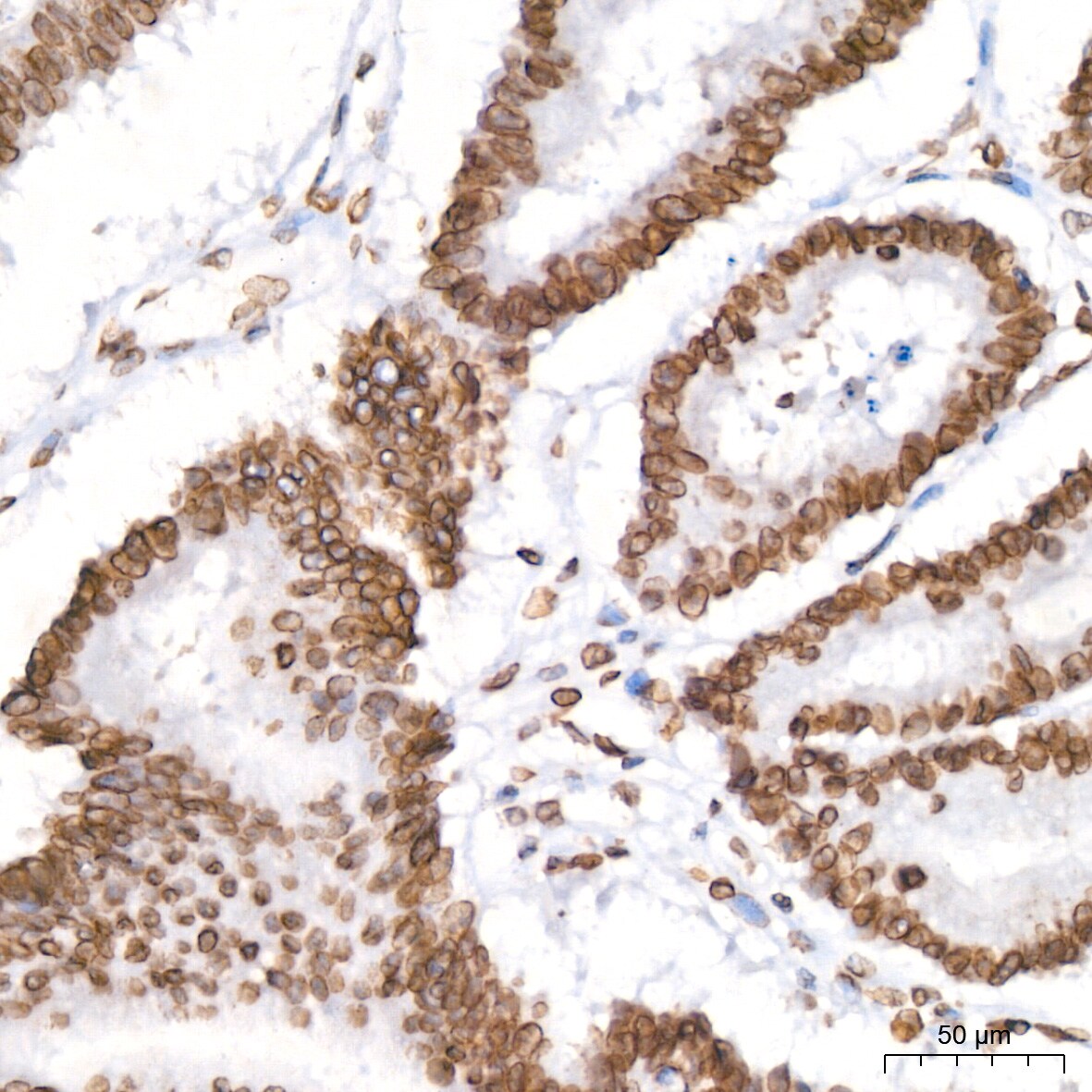 Lamin B2 Antibody (1S9M6)