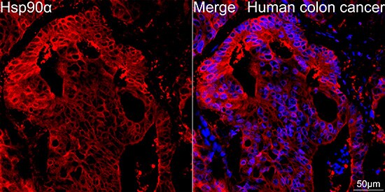 HSP90 alpha Antibody (0R3S6)