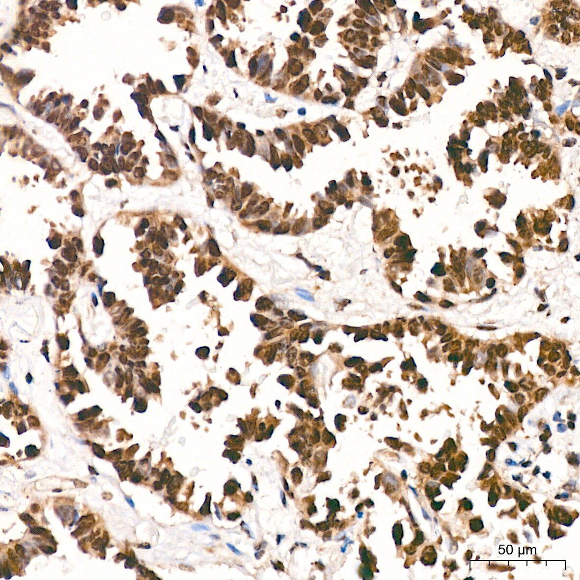 DDB1 Antibody (9L8X5)