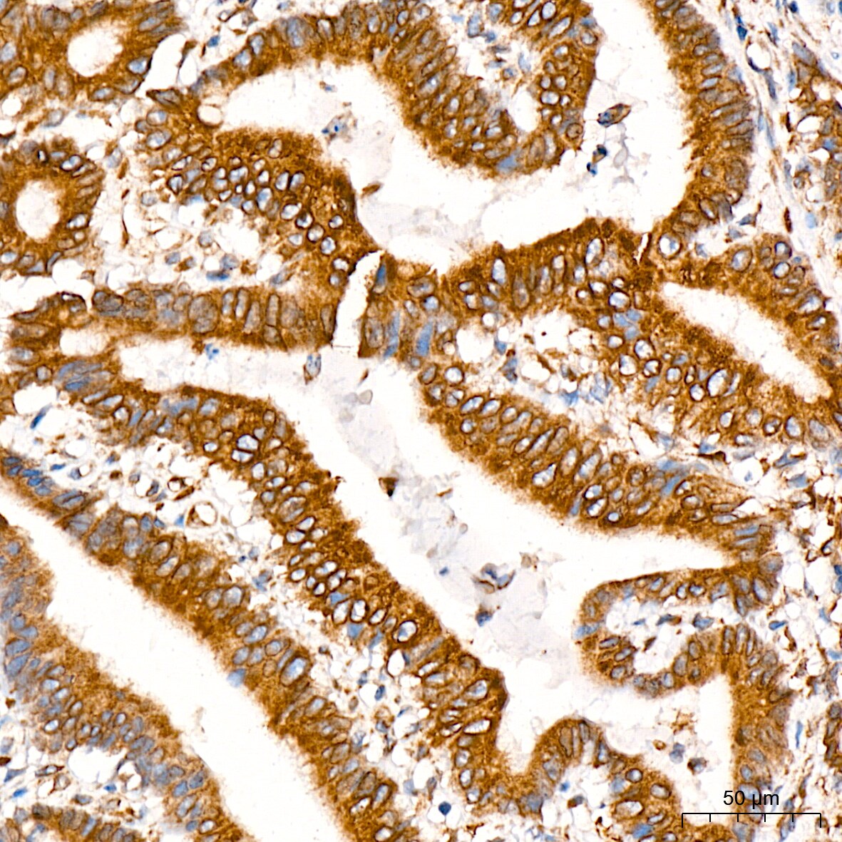 POR/Cytochrome P450 Reductase Antibody (9U1U7)