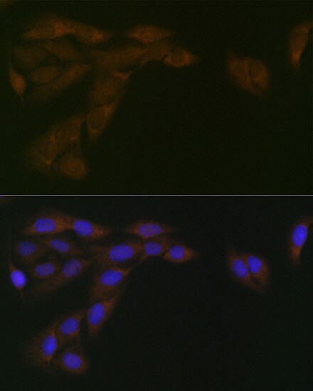 POR/Cytochrome P450 Reductase Antibody (9U1U7)