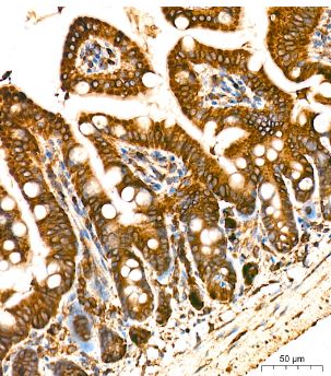 POR/Cytochrome P450 Reductase Antibody (9U1U7)