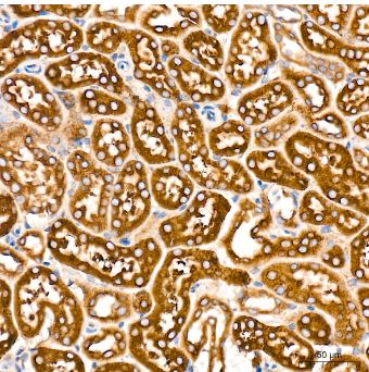 POR/Cytochrome P450 Reductase Antibody (9U1U7)