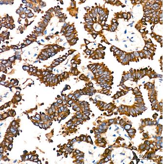 POR/Cytochrome P450 Reductase Antibody (9U1U7)