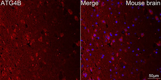 ATG4B Antibody (9H6M6)