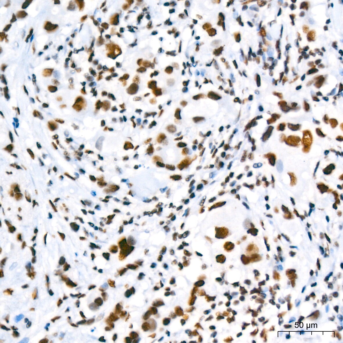 SUMO2/3 Antibody (6R8G7)