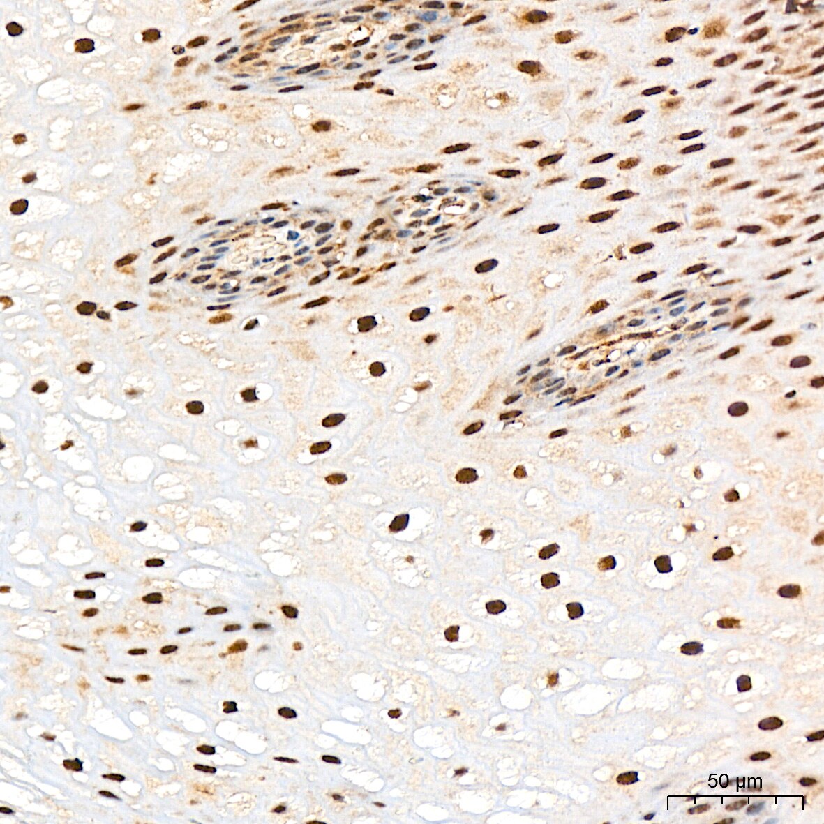 Proteasome 20S alpha 3 Antibody (7X8W9)