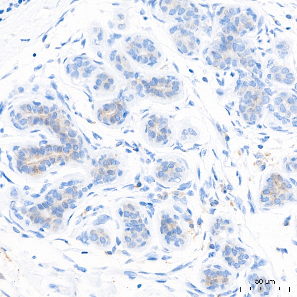 PAR2 Antibody (9X8E6)