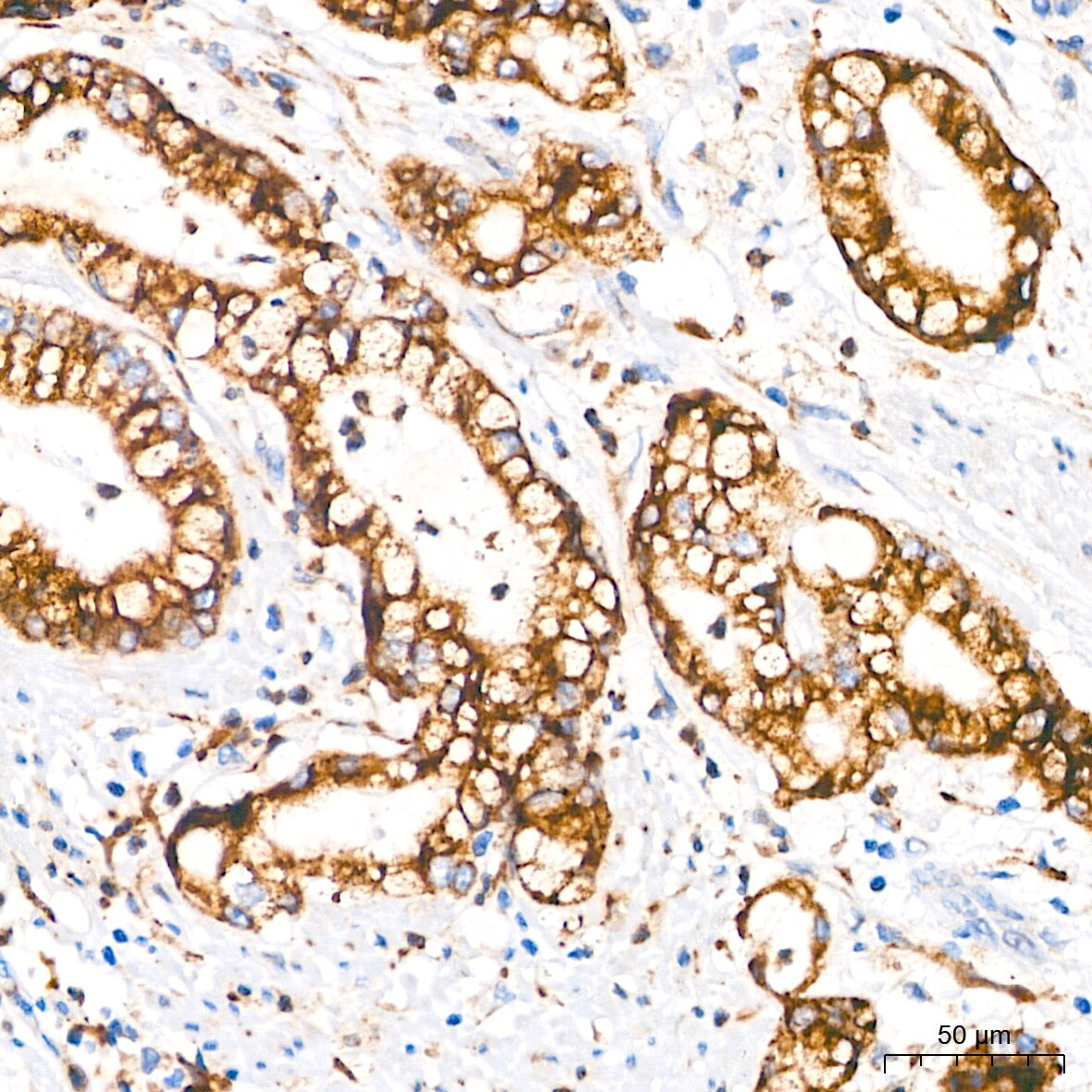 PAR2 Antibody (9X8E6)