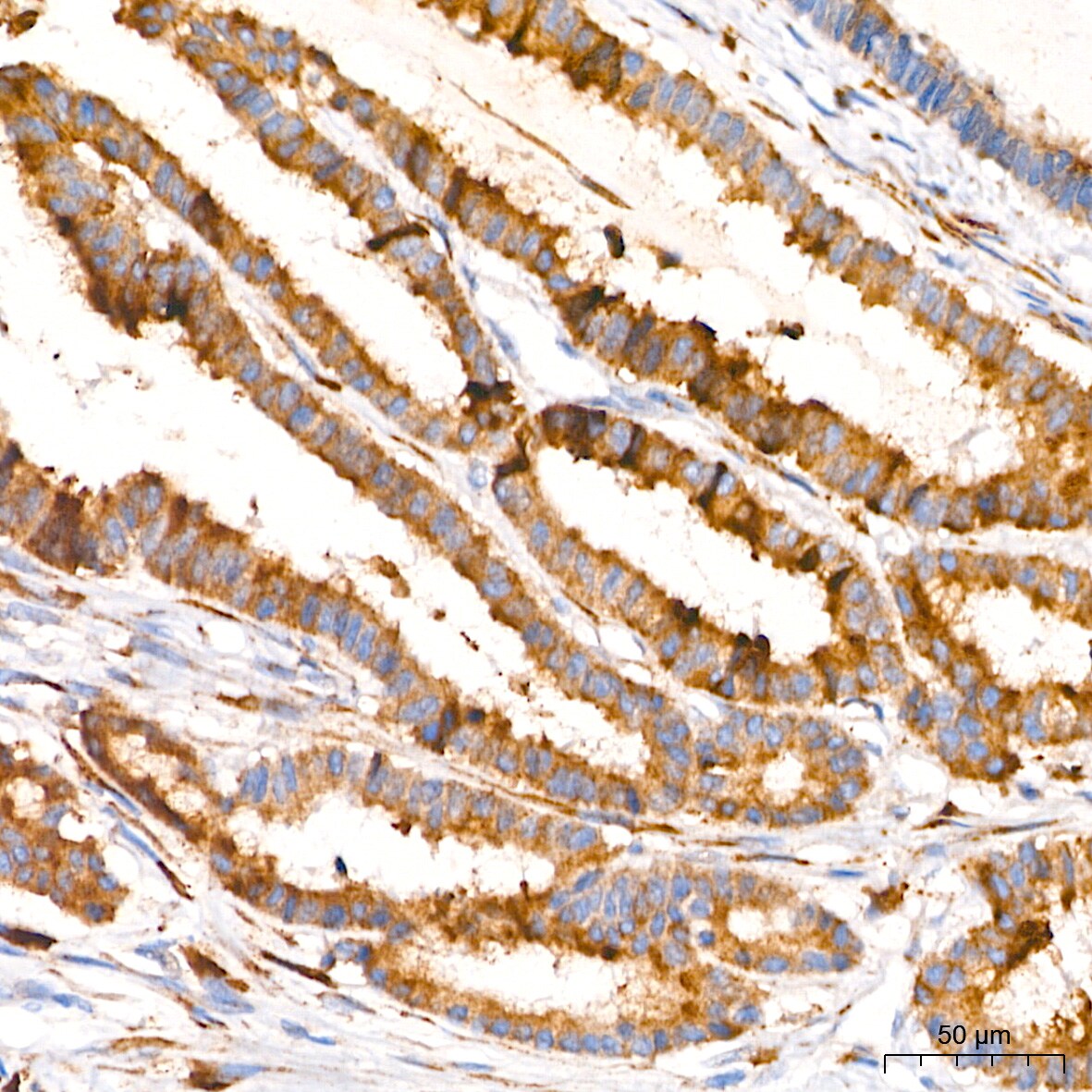 PAR2 Antibody (9X8E6)