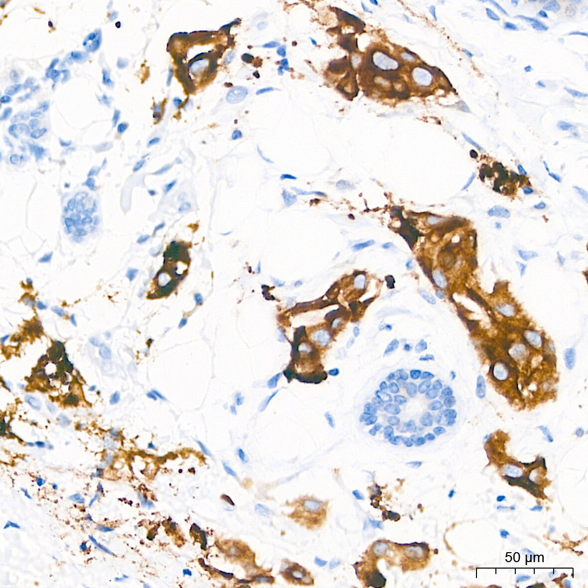 PAR2 Antibody (9X8E6)