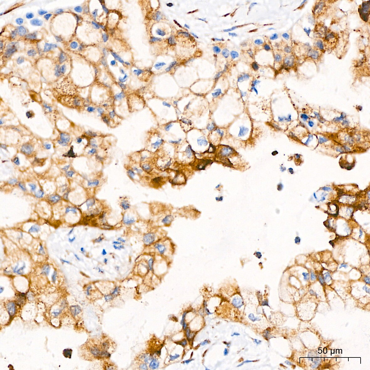 PAR2 Antibody (9X8E6)