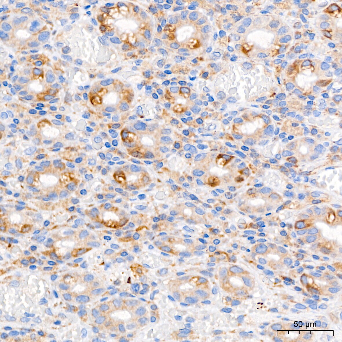 PAR2 Antibody (9X8E6)