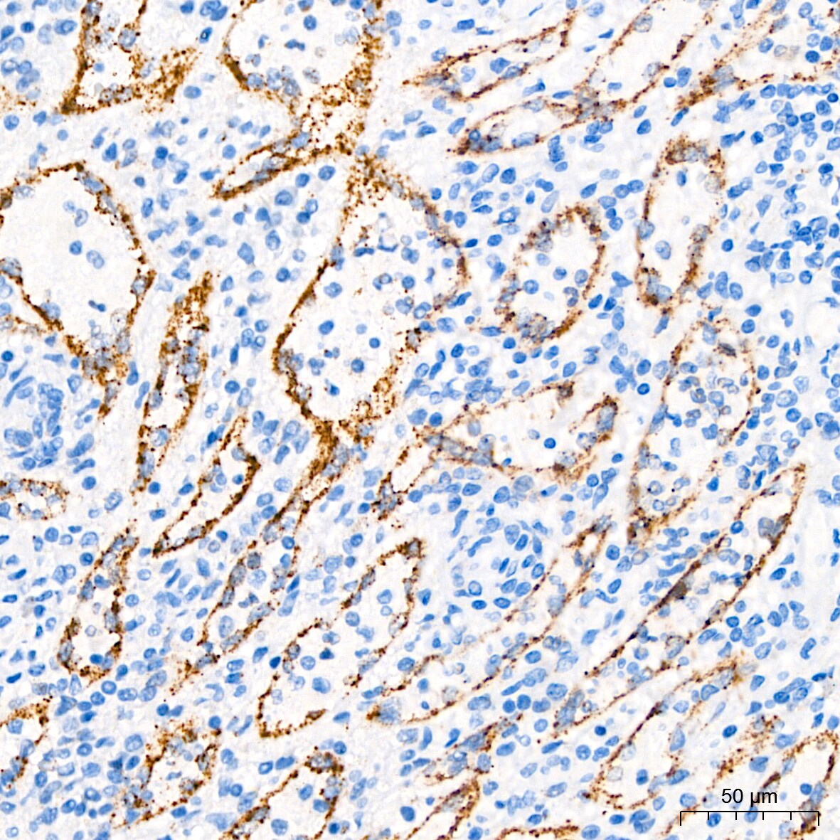 PAR2 Antibody (9X8E6)