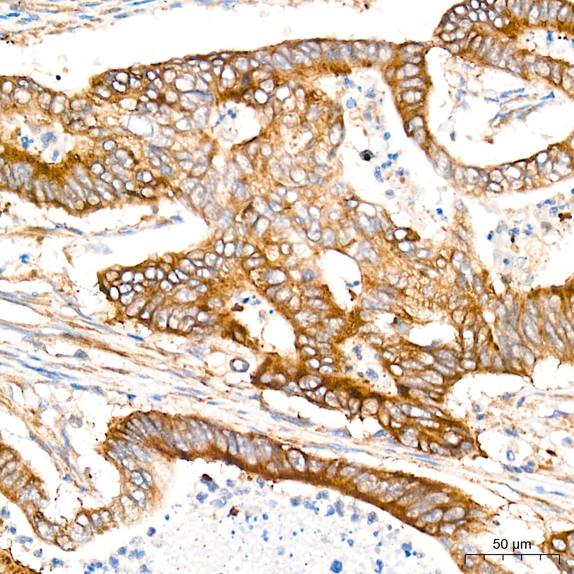 PA2G4/EBP1 Antibody (9J9U5)