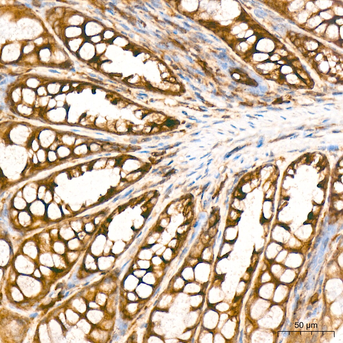 PA2G4/EBP1 Antibody (9J9U5)