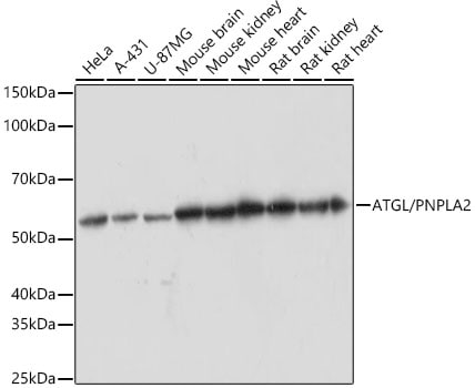 PEDFR/PNPLA2/ATGL Antibody (10Y4M10)
