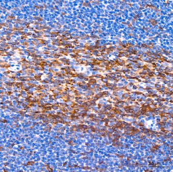 Muscarinic Acetylcholine Receptor M2/CHRM2 Antibody (3T5W8)