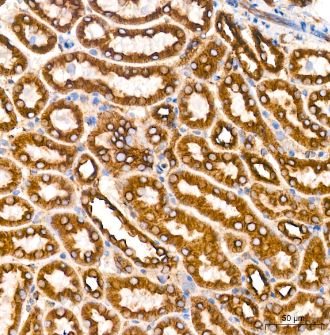 Muscarinic Acetylcholine Receptor M2/CHRM2 Antibody (3T5W8)