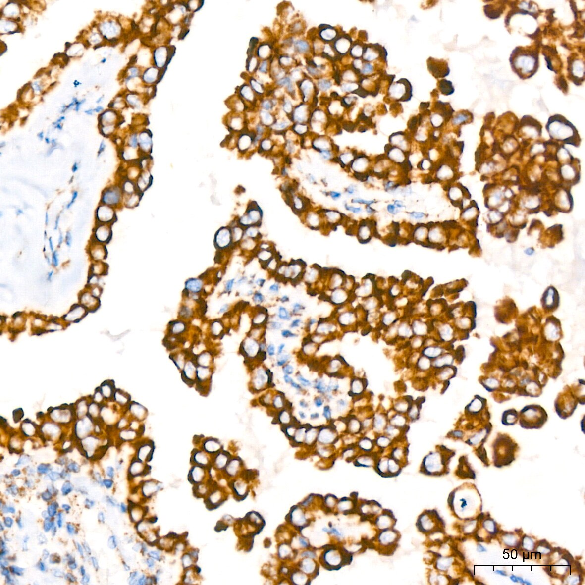 Glutamate Dehydrogenase Antibody (7L7N2)