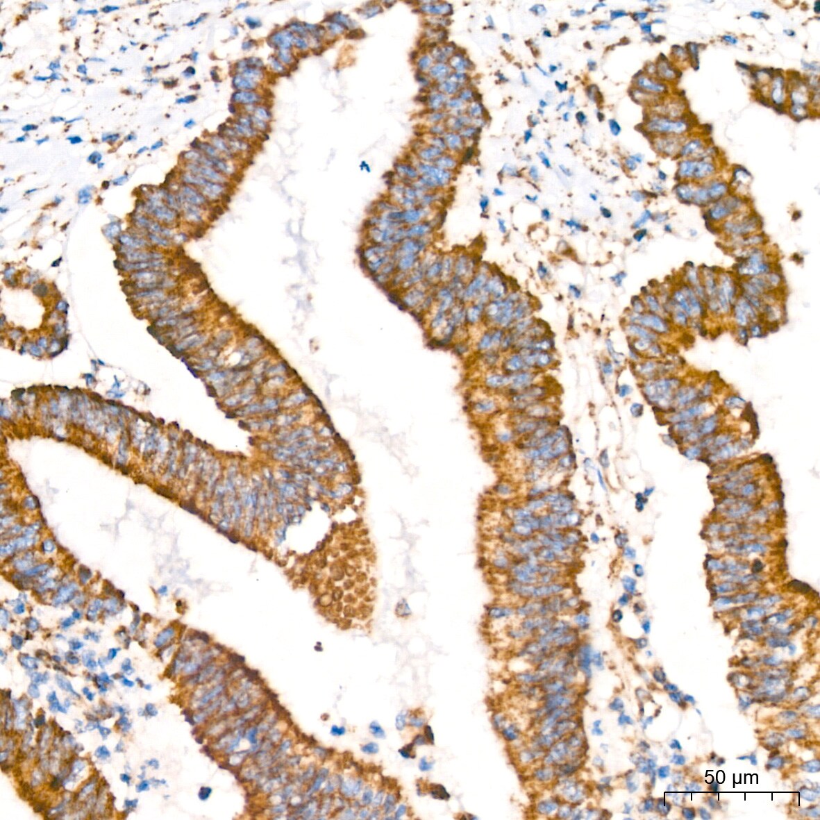 Glutamate Dehydrogenase Antibody (7L7N2)