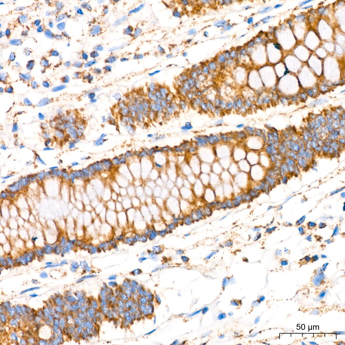 Glutamate Dehydrogenase Antibody (7L7N2)