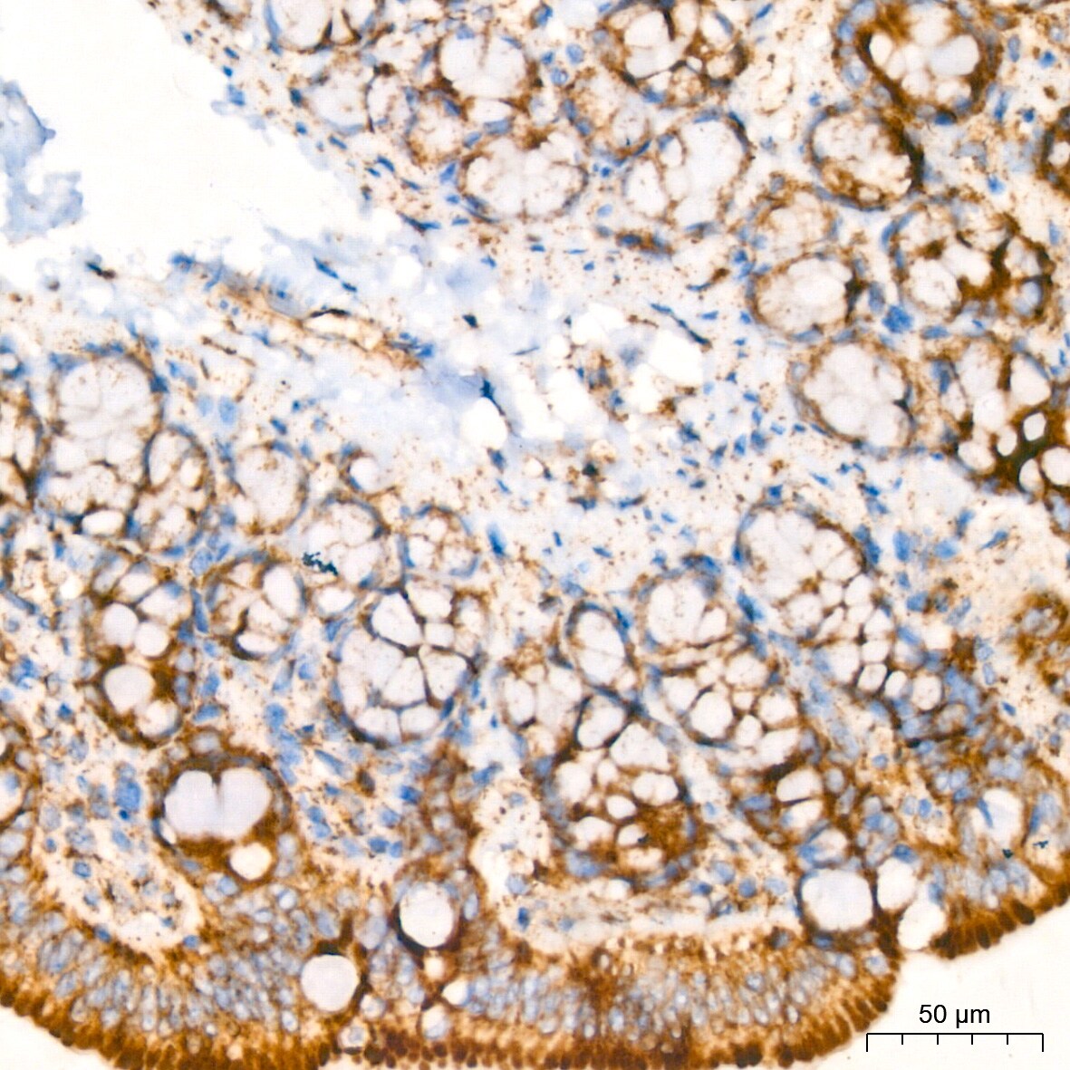 Glutamate Dehydrogenase Antibody (7L7N2)