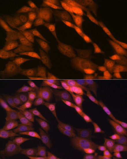 p23/PTGES3 Antibody (10M9W8)