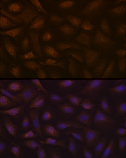 KIFAP3 Antibody (1S7J7)