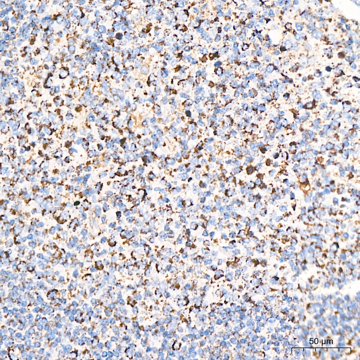 Dihydrolipoamide Dehydrogenase/DLD Antibody (3J2O9)