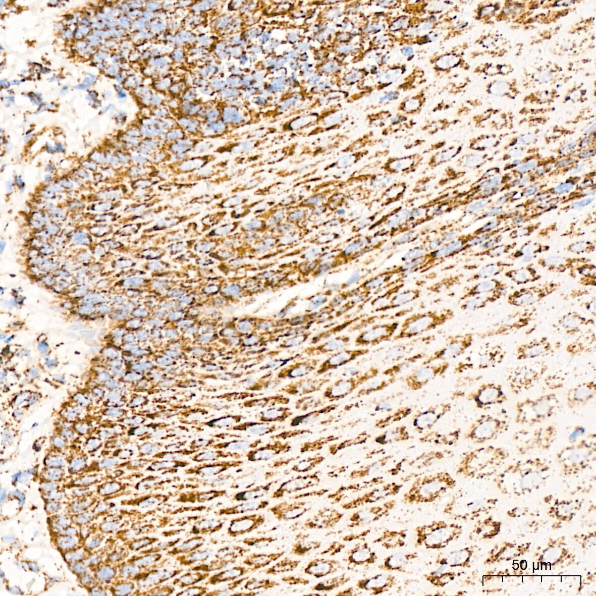 Dihydrolipoamide Dehydrogenase/DLD Antibody (3J2O9)