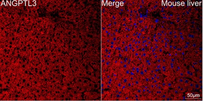 Angiopoietin-like Protein 3/ANGPTL3 Antibody (4W9A7)