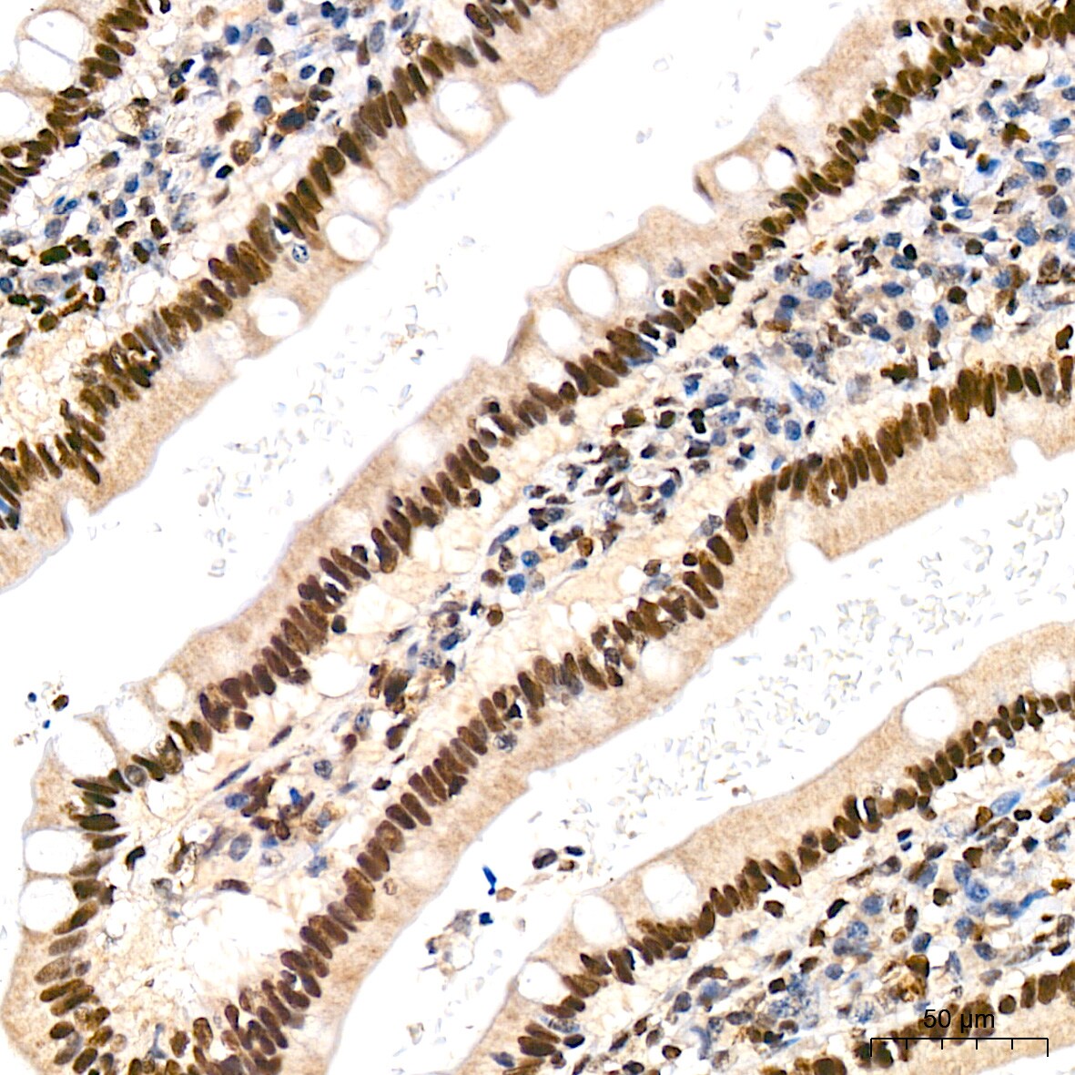 JunD Antibody (2D5A1)