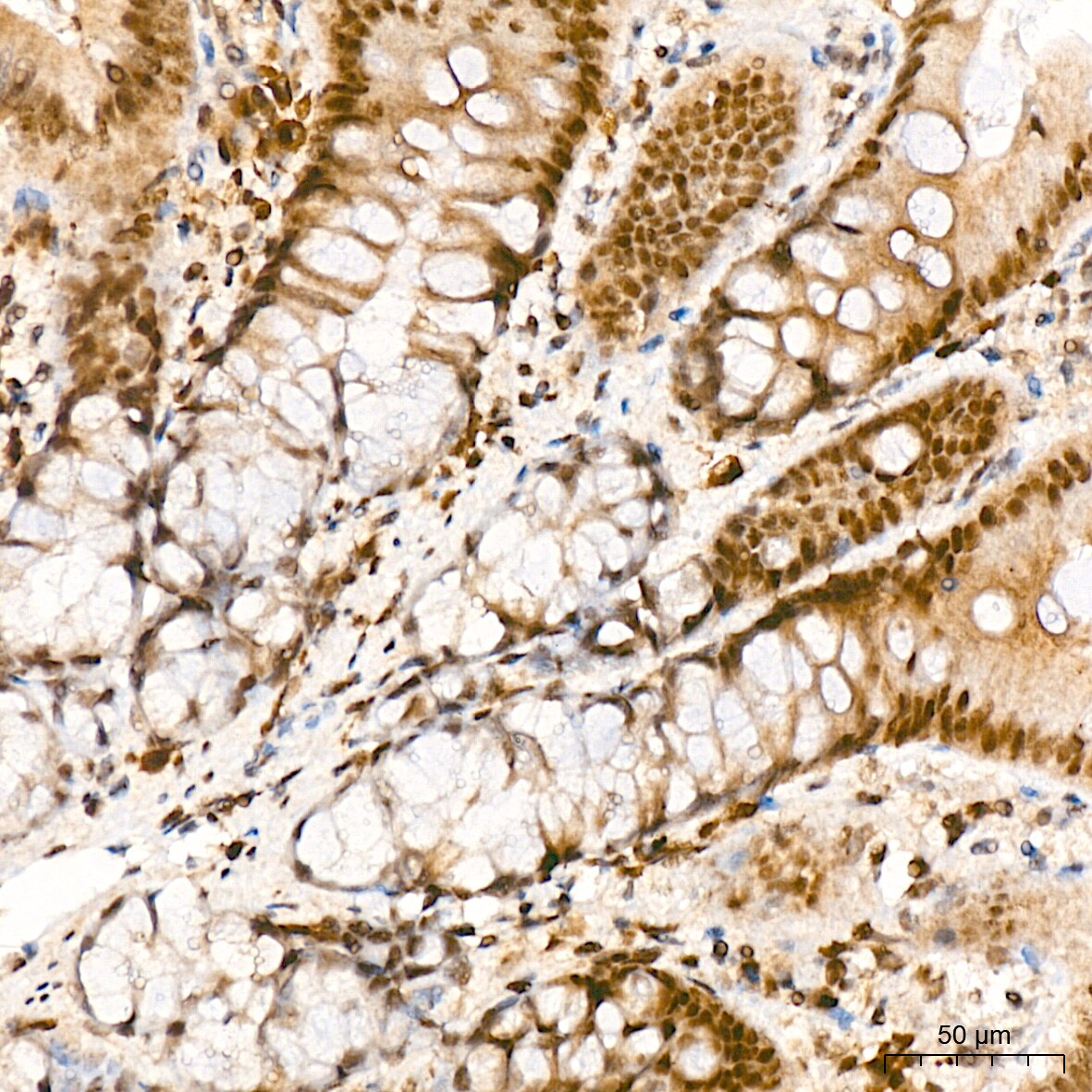 JunD Antibody (2D5A1)